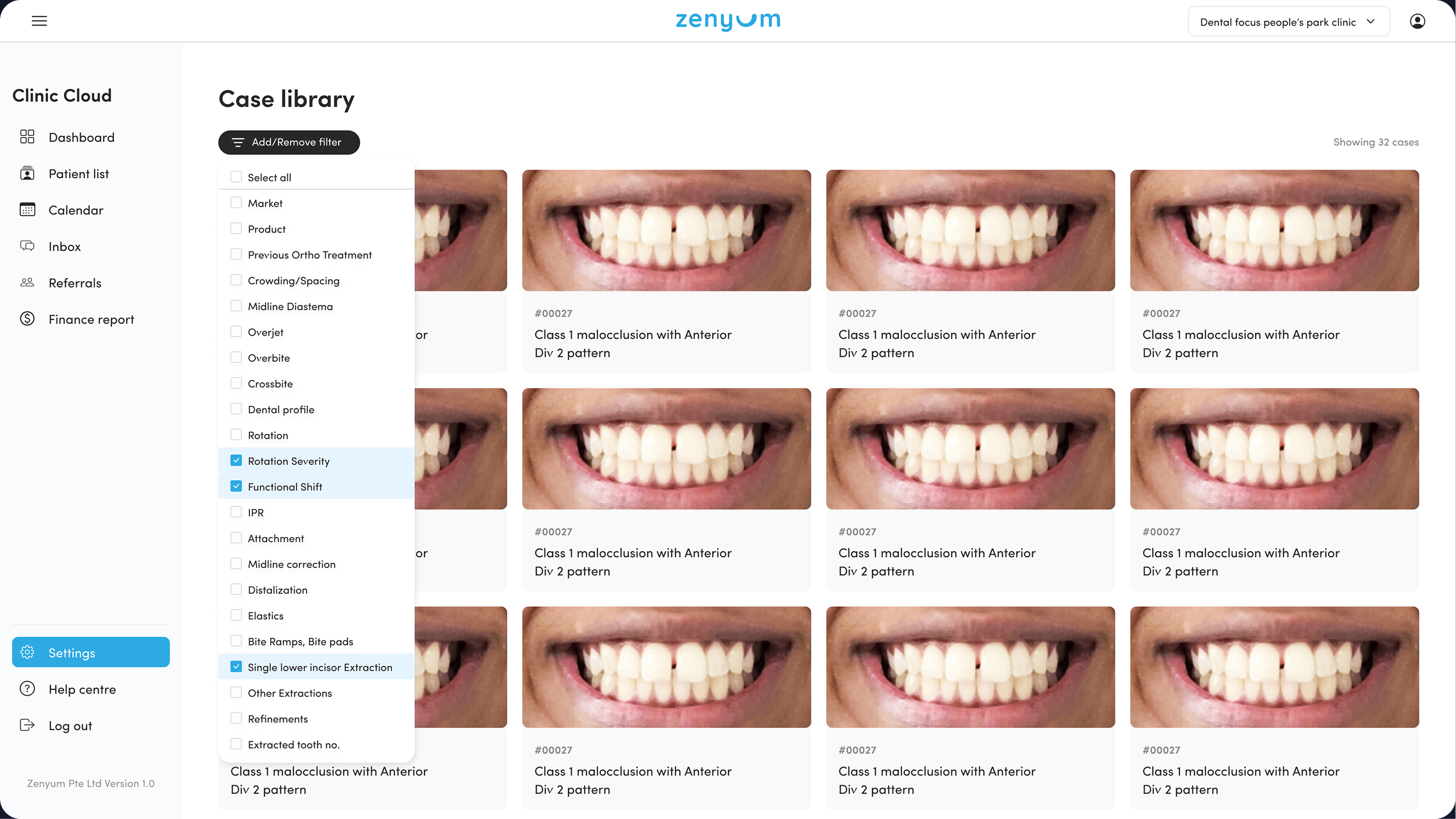 Case library overview